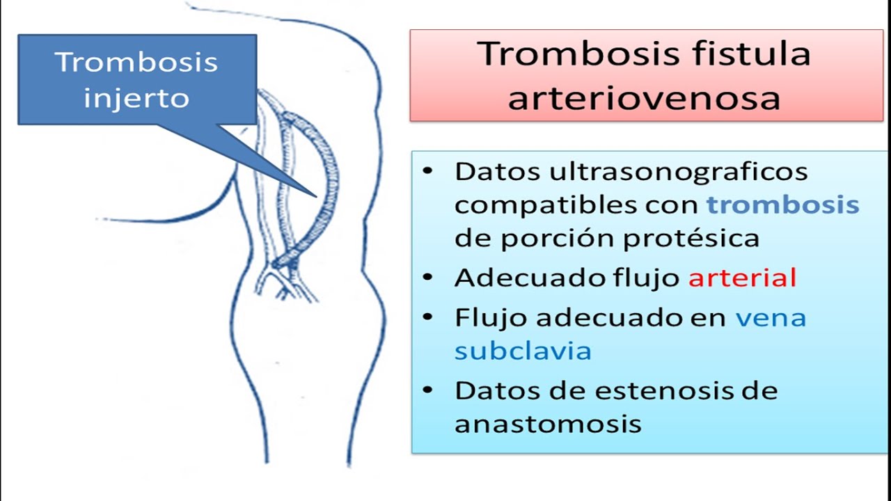 Riky Luis Perez Lucas-2
