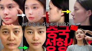 Plastic surgery in China, this is the price? (Actual estimate) + doctor's salary + hospital mont...