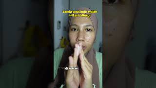Download lagu Pertolongan pertama kulit alergi / iritasi merah dan gatal 🙌🏻 #cicaplastbaume #larocheposay mp3