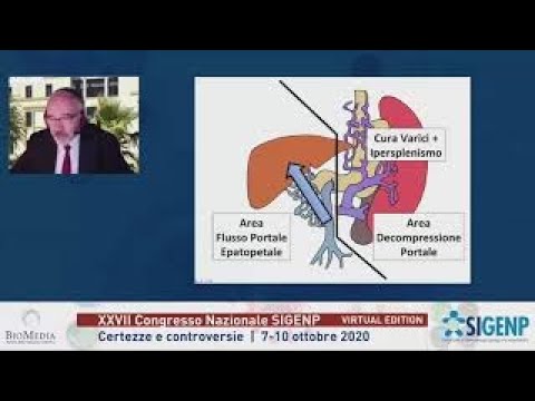 Cavernoma della vena porta – che altro intervento quando il MesoRex non è possibile?