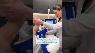 Download lagu CoolSculpting Elite at The Skin Center mp3
