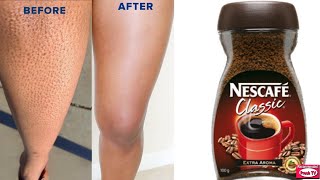 How to Get Rid of Strawberry Legs with Coffee in 1 Day Naturally at Home is always 100% working
