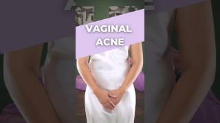 Vaginal Acne/Pimples On Private Parts | How To Treat Them | How Are They Caused? | #aqneeq #acne