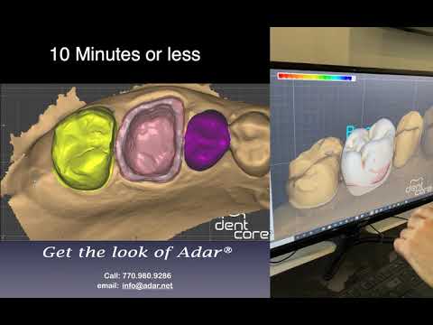 Exocad Single Crown Design(10 minutes or less)