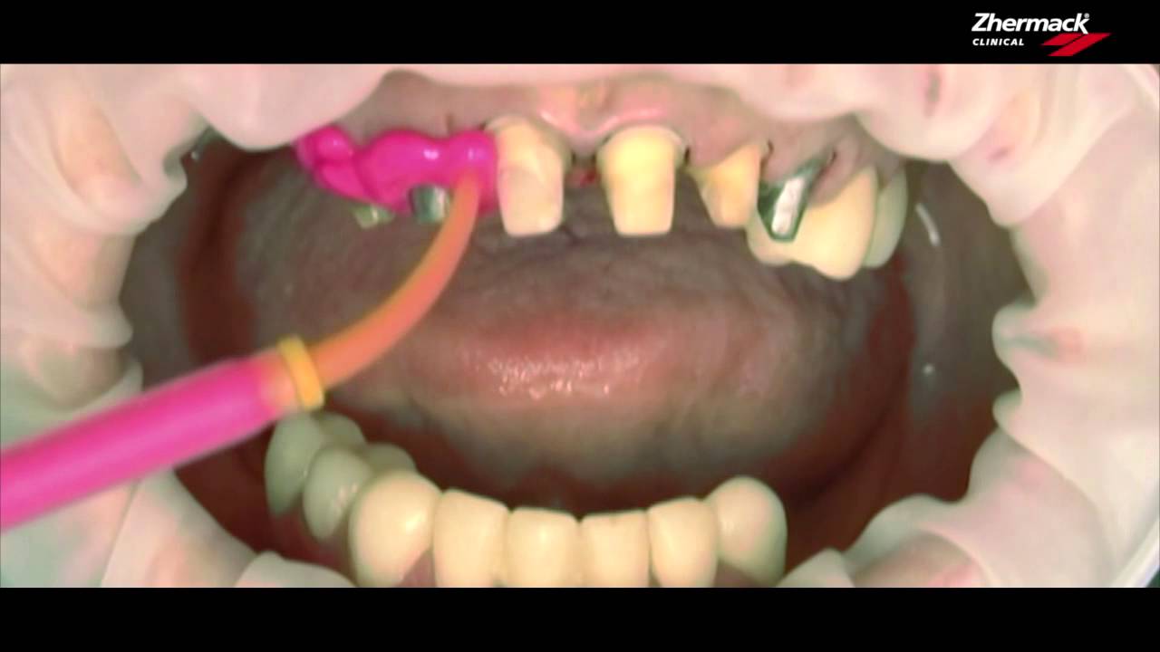 Hydrorise Video(Anglais)