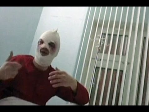 Russia probes acid attack on Bolshoi chief