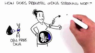 Prenatal Screening Options: cfDNA (cell free DNA)