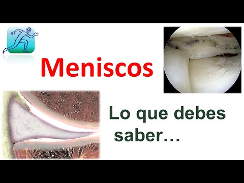 Lesiones de los Meniscos
