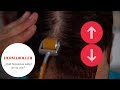 ¿QUÉ NECESITAS SABER DEL DERMAROLLER PARA LA CAÍDA DEL CABELLO?