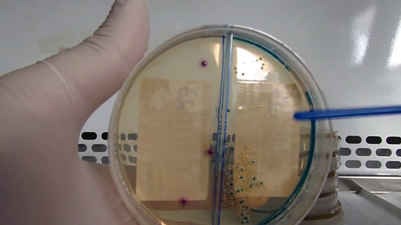 Urocultura - Como o Biomédico deve interpretar o crescimento bacteriano nas culturas de urina