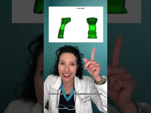Airway Expansion Before and After!