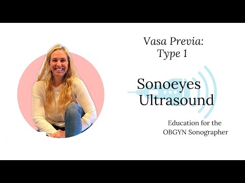 Vasa Previa by Ultrasound for Sonographers: Type 1