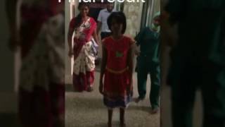 The magic of ilizarov