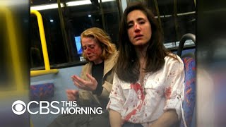 Victim of homophobic bus attack speaks out