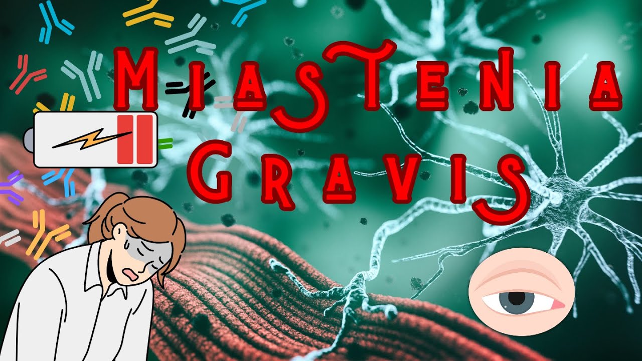 MIASTENIA GRAVIS