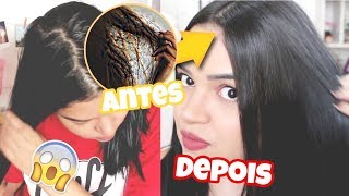 UMECTAÇÃO COM ÓLEO DE RÍCINO, PASSO A PASSO (VAI SALVAR SEU CABELO) ♥