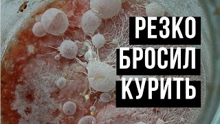 Что будет, если резко бросить курить? 🚬Мой опыт, советы бросающим. История из моей жизни.