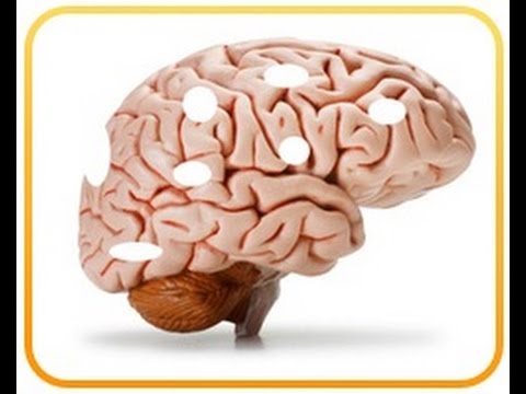 脳を高める食品 - あなたの脳に害を与える最悪の1つの食品 (Brain Boosting Foods - The 1 Worst Food that Harms Your Brain)