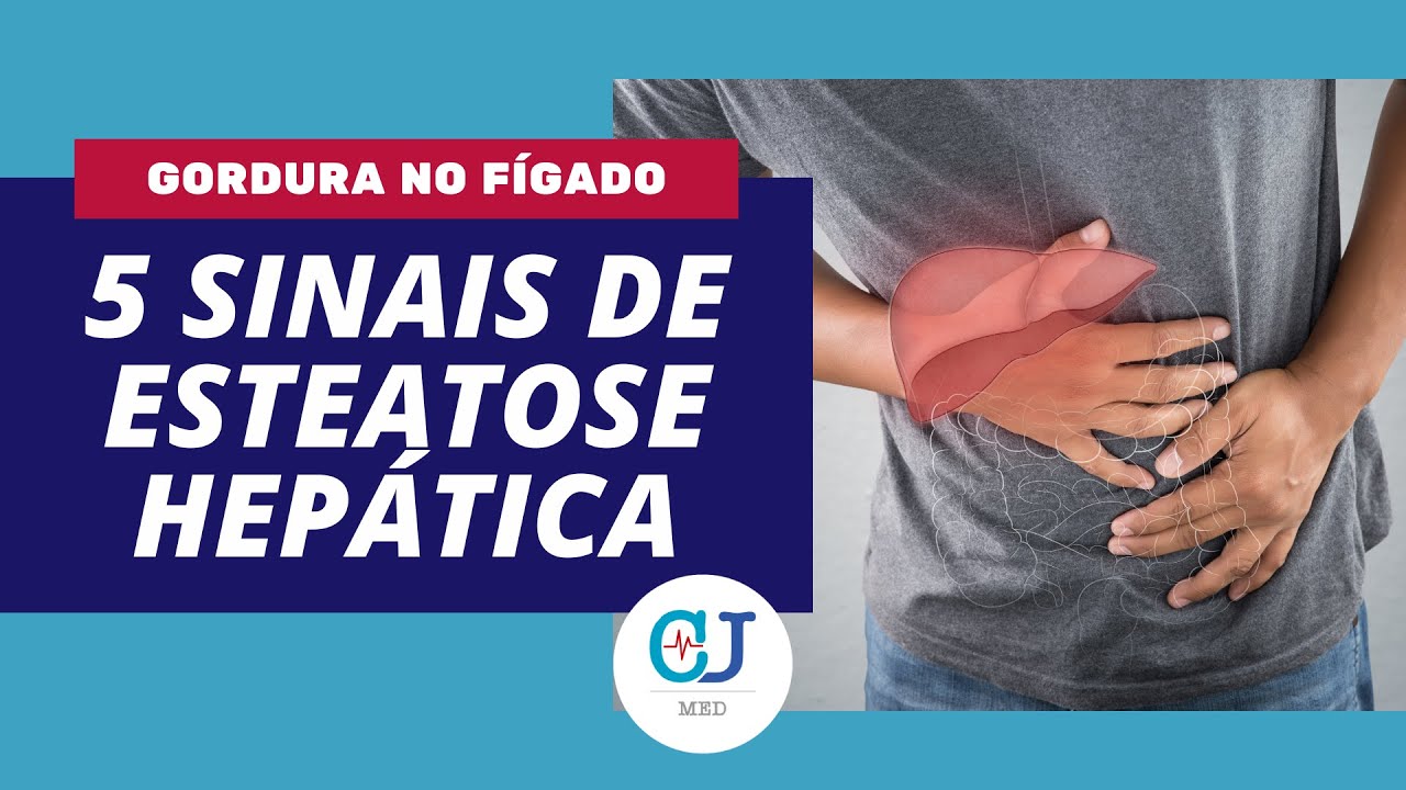 Cardiologista responde: 5 Sinais de Esteatose Hepática (Sintomas de Gordura no Fígado)