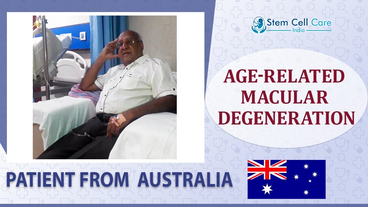 Patient with Age-related Macular Degeneration shares his experience at SCCI| Stem Cell for ARMD
