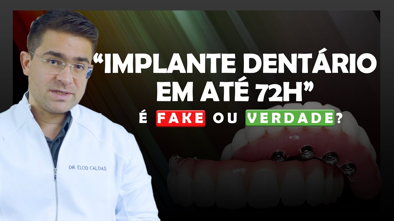 IMPLANTE DENTÁRIO EM 3 DIAS (CARGA IMEDIATA)  - CUIDADO, PODE SER GOLPE!!!!
