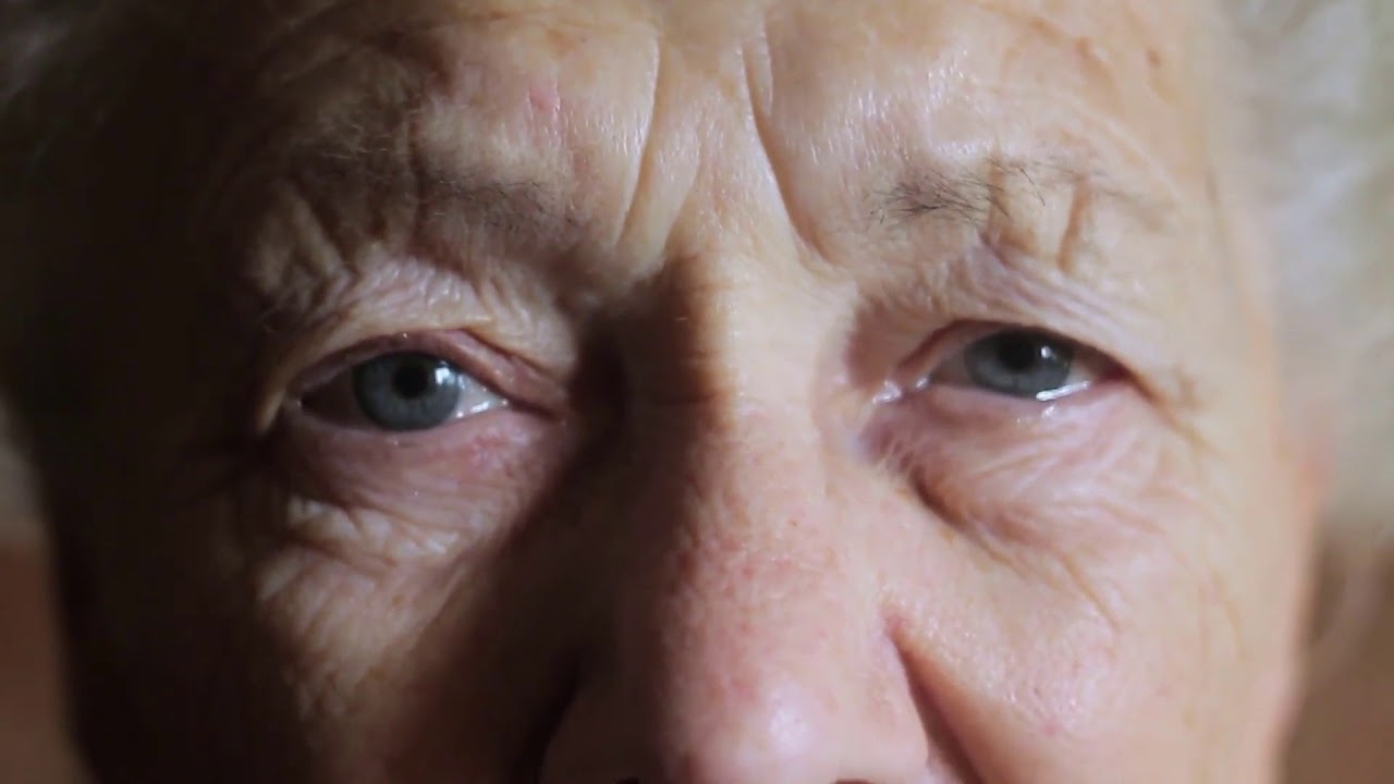 Watch Now Che cos'è l'ossalato di calcio Che cos'è l'ossalato di calcio