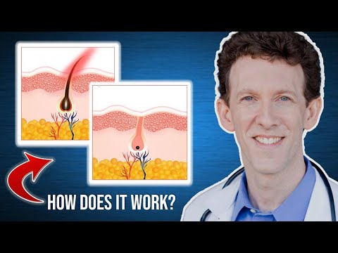 How Does Laser Hair Removal Work?