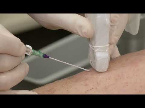 BD Cue™ Needle Tracking System with BD Prevue™ II Vascular Access System