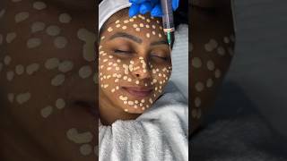 Download lagu BB glow treatment for instant glow at the glam room now at-₹9999 mp3