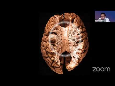 VI Congreso #REDLarousse  Eduardo Calixto  Enséñale al cerebro quién manda