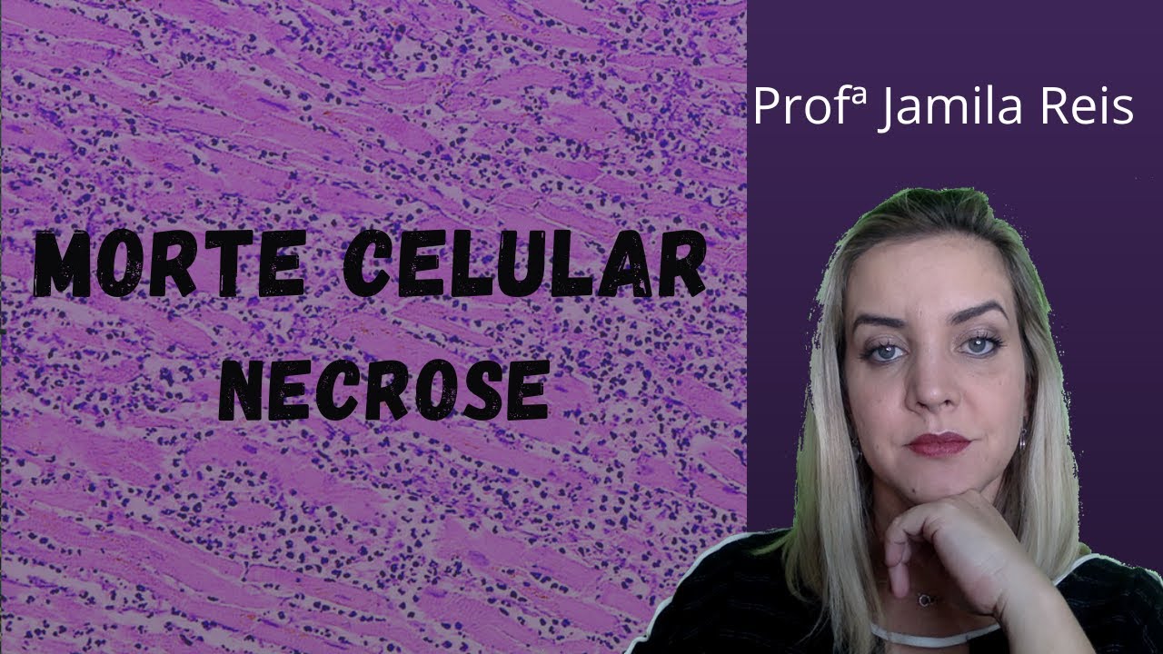 Morte celular - Necrose