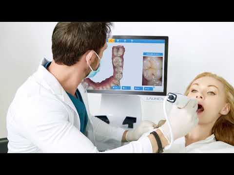 Launca Scanner Promotion Video