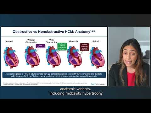 Making Strides in Hypertrophic Cardiomyopathy: Guidelines, Science, and Strategies