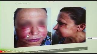 В Чечне создадут реестр лицензированных специалистов по пластической хирургии