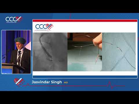 Jasvindar Singh  Case  2 My Worst Nightmare A Complication from Hell!