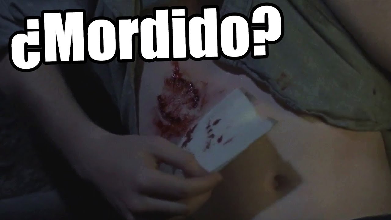 ¿MORDIDO? ¿QUE PASARÁ? - The Walking Dead Temporada 8 Capítulo 8