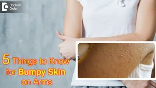 Get rid of Bumpy Skin on Arms | Keratosis Pilaris - Dr. Divya Sharma |Doctors