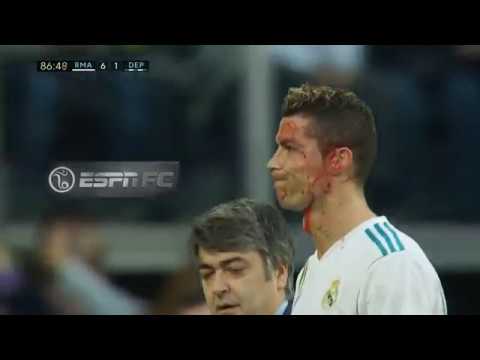 Cristiano pidió un teléfono para ver cómo sangraba