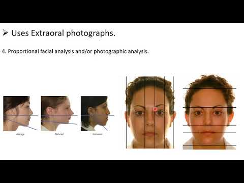 Diagnostic Records Study Models And Photographs   Part 2 1