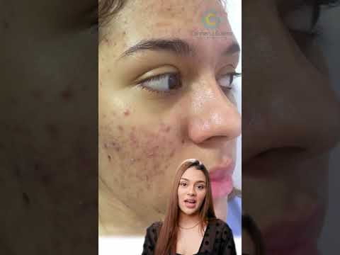 video YrMXLywEMc0