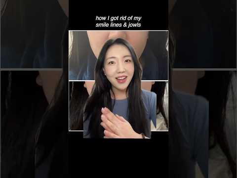 How I got rid of my smile lines (part 1)