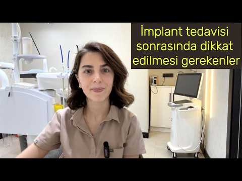 İmplant Uygulaması Sonrasında Dikkat Edilmesi Gerekenler