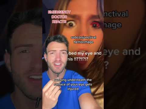 Completely Red Eye But NOT Painful?