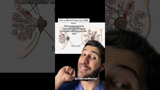 Download lagu This is What Clogs up a Milk Duct #breastfeeding A clogged milk duct, a common issue for breastfeedi mp3