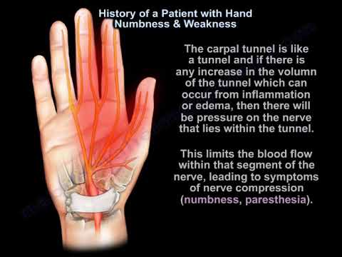 Carpal Tunnel Syndrome  symptoms and treatment - Everything You Need To Know - Dr. Nabil Ebraheim