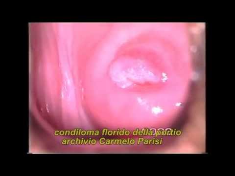 Come trattare il mal di schiena e reumatici dolori articolari epub Non steroidei anti-infiammatori agente in osteocondrosi