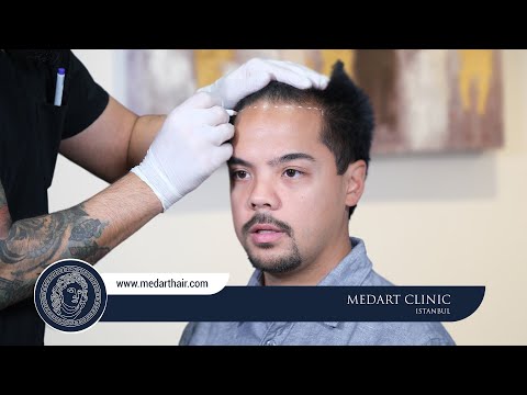 Hair Transplant Turkey | Medart Hair Clinic Istanbul