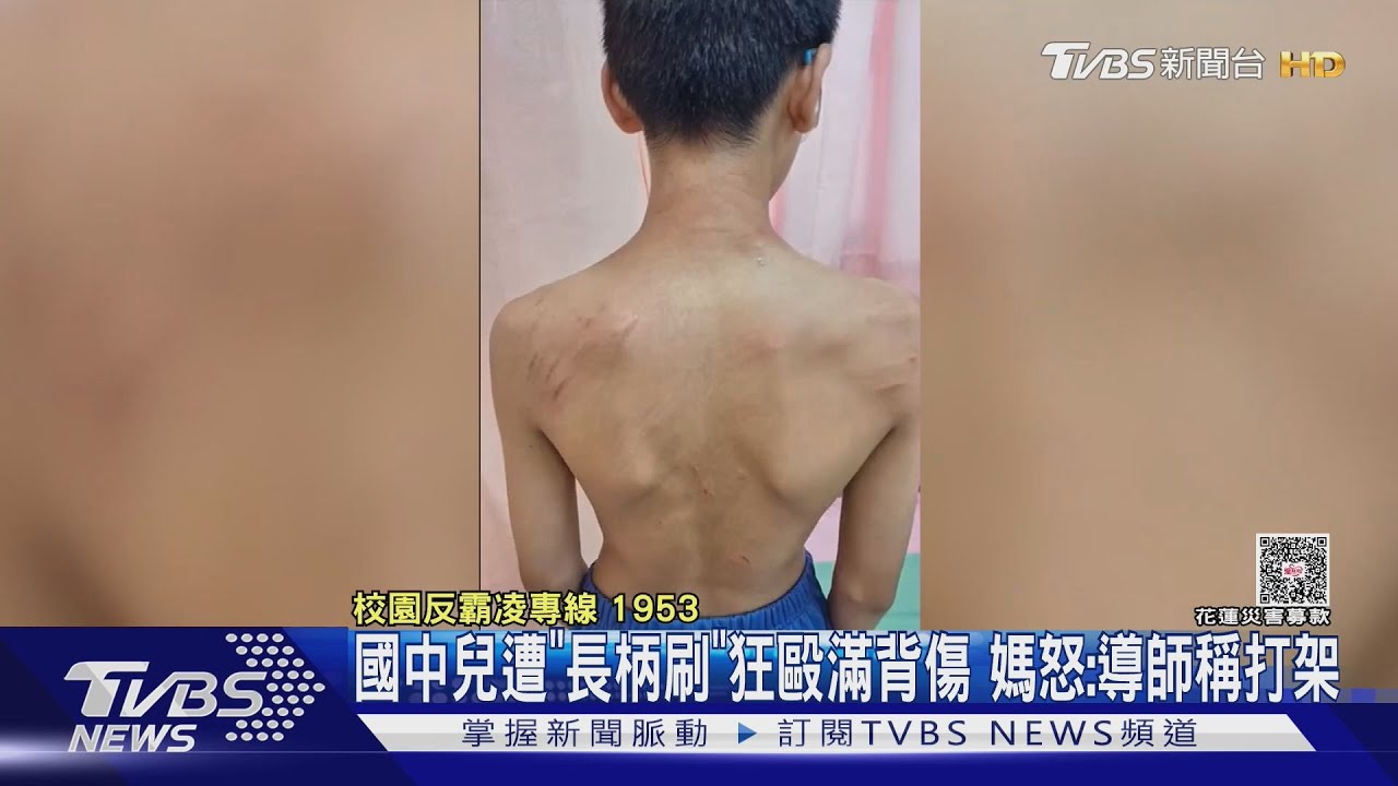 一場打掃釀慘劇!馬桶刷水花惹怒同學 國中生遭暴打滿背傷