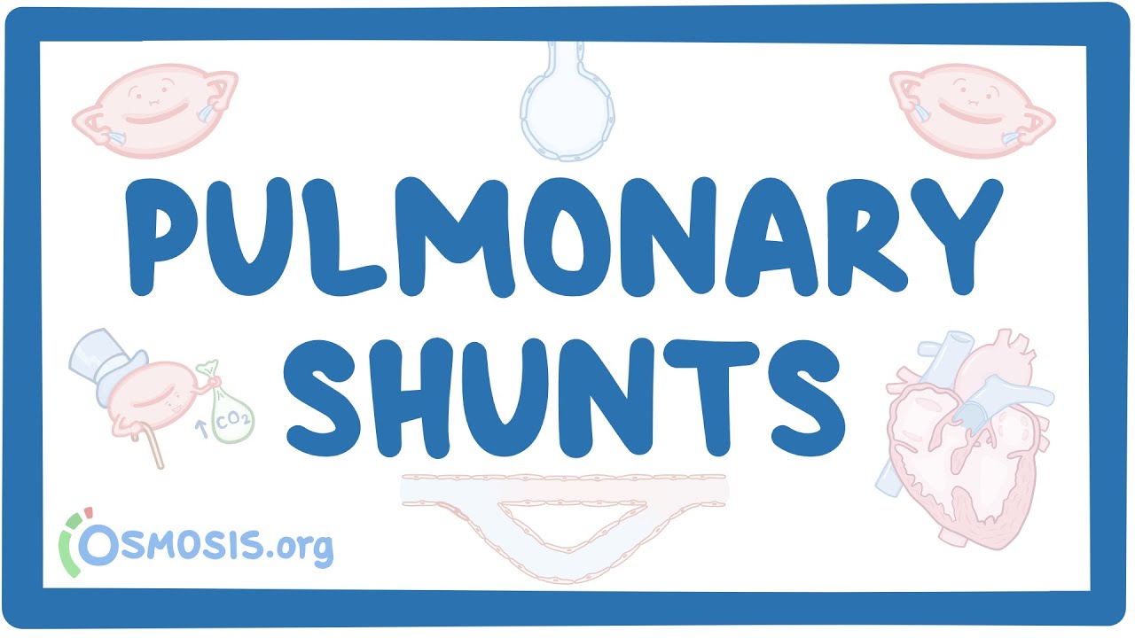 Pulmonary shunts