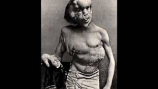 &quot;Reviving the Elephant Man&quot; (Forensic Reconstruction)